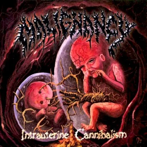 Intrauterine Cannibalism — Malignancy