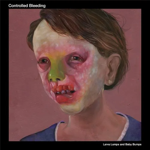 Larva Lumps and Baby Bumps — Controlled Bleeding