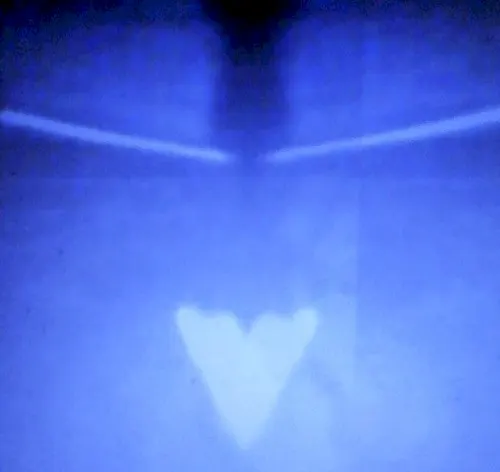 M▲LK▼TH — Killerwytch