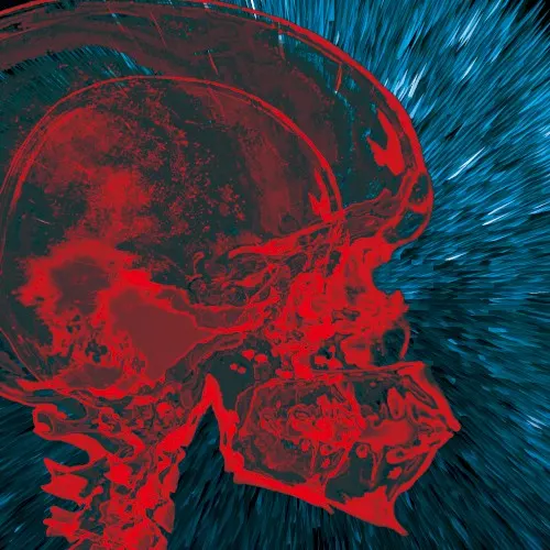 Altered Brain Data Explosion — KK Null